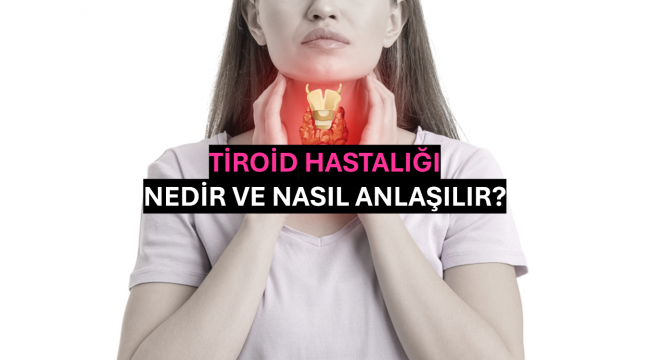 Tiroid Hastalığı Nedir ve Nasıl Anlaşılır?