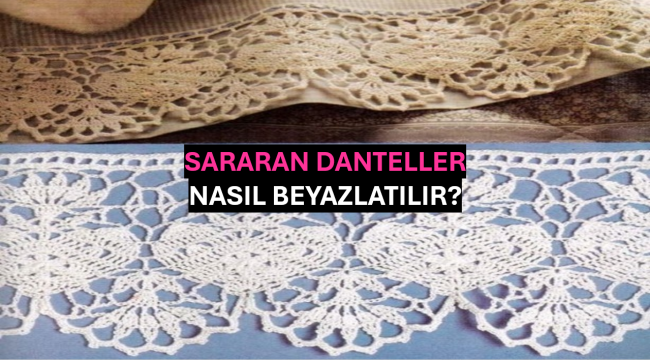 Sararan Danteller Nasıl Beyazlatılır?