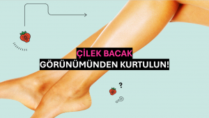 Çilek Bacak Görünümünden Kurtulun!