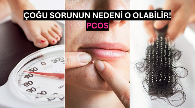 Polikistik Over Sendromu (PCOS)